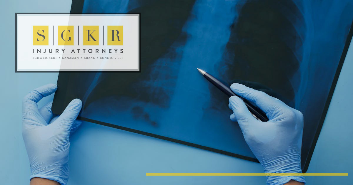 Is Mesothelioma More Prevalent Among Men or Women?