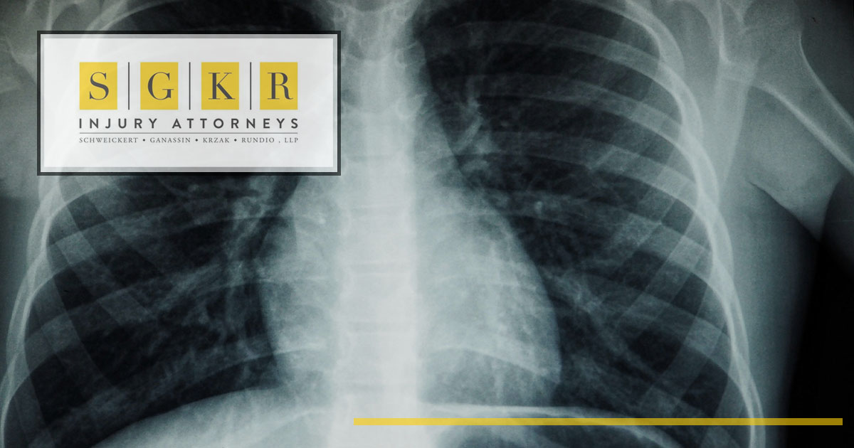 Is Asbestos the Only Cause of Mesothelioma?